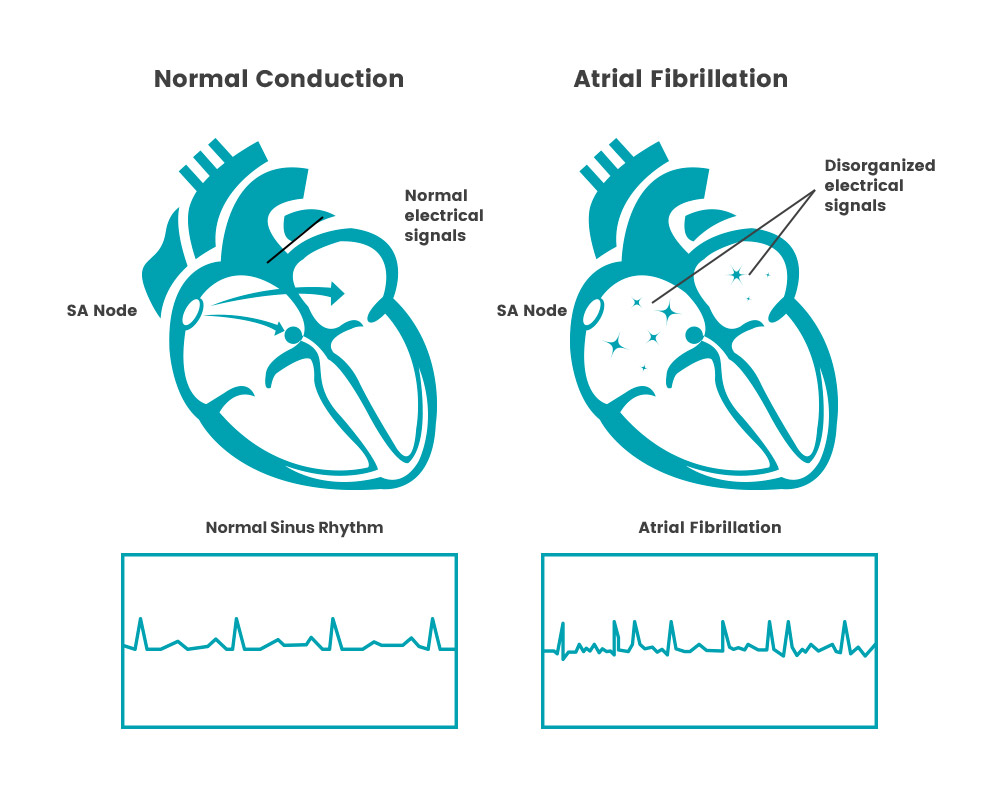 cardiac diagram